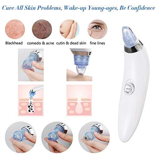 Derma Suction Facial Pore Cleanser - Blackhead Whitehead Remover Vacuum Suction Machine for Women